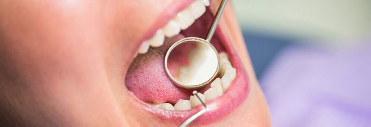 Oral Oncology